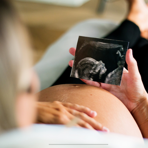 Onewa Parents Centre Antenatal Course